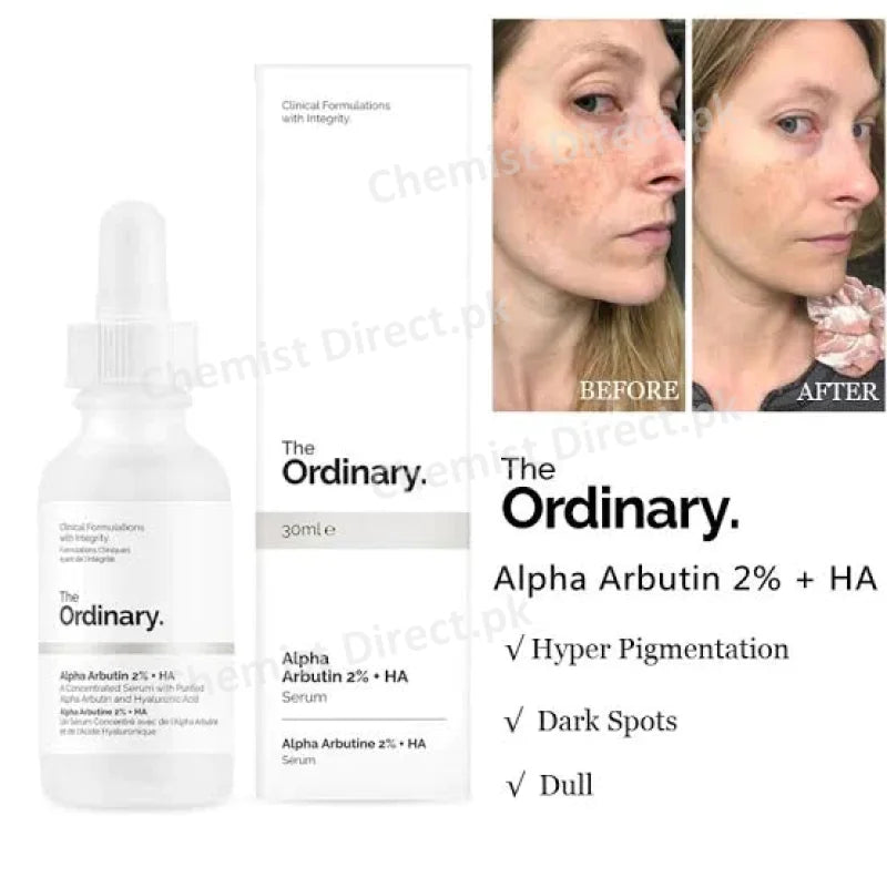 The Ordinary Alpha Arbutin 2% + Ha Serum